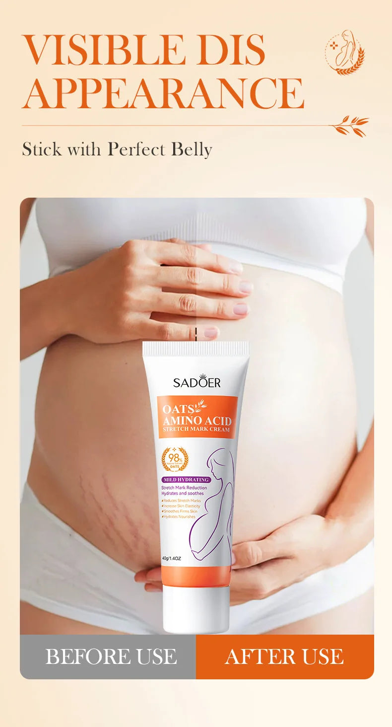 ✨ Creme Antiestrias e Firmador – Hidratação e Firmeza para Gestantes